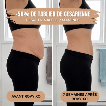 Culotte Gainante Post-Grossesse — Maintien 360°